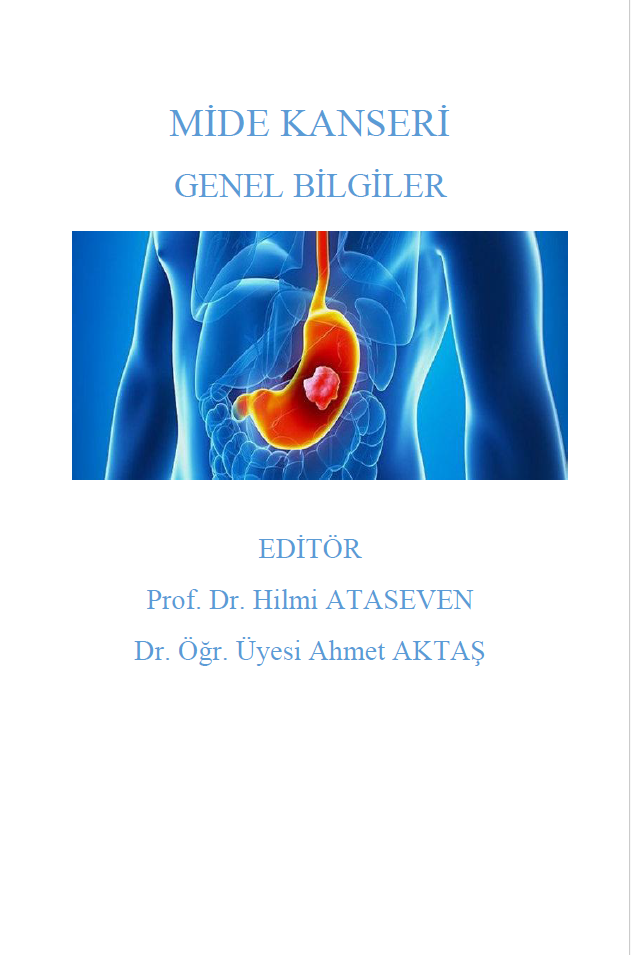 Mide Kanseri Genel Bilgiler